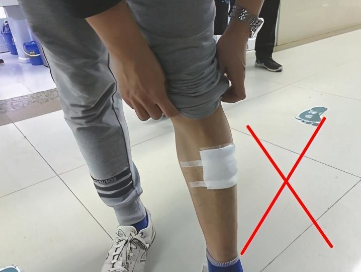 狗咬伤怎么处理伤口?狗咬伤的自我早期防护处理 狗咬伤怎么处理伤口?狗咬伤的自我早期防护处理