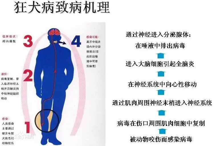 【世界狂犬病日】关于狂犬病疫苗注射的那些问题 【世界狂犬病日】关于狂犬病疫苗注射的那些问题